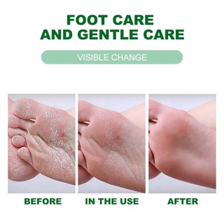Crema exfoliante Para el cuidado del Sol/exfoliación/crema Para el cuidado de los pies