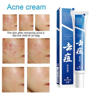 Effective Acne Removal Cream Acne Treatment Anti-acne Repair Fade Acne Spots Oil Control Whitening Face Skin Gel Care