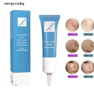 Nvryccoky 15g Scar Removal Cream Acne Scars Gel Stretch Marks Acne Pigmentation Body Burn MX