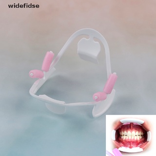 widefidse 3D Oral Abridor De Boca Dental Intraoral Mejilla Lip Retractor Prop Ortodoncia Adulto [Caliente]