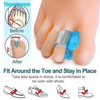 Thevatipoem 2 pzs separador de dedo del dedo del dedo del pie de Gel de silicona separador de alisador para aliviar el dolor