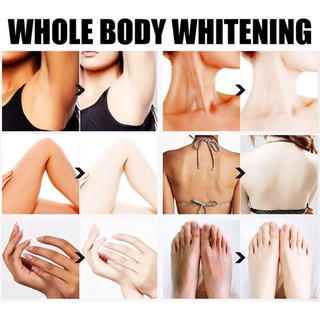 blanqueamiento facial y crema corporal es adecuado para la oscuridad sensible y áreas. blanqueamiento de la piel, rodillas m1l4 (5)
