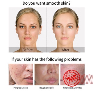 LAIKOU Vitamin C Face Serum Japan Hyaluronic Acid 24K Skin Gold Serum Whitening Care Face A2M3