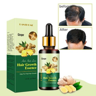 Listo Stock jengibre crecimiento del cabello esencia prevenir la pérdida de cabello suero de crecimiento para hombres mujeres 30ml