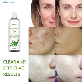 astarts.mx eficaz acné gel de aloe cuidado de la piel aloe vera hidratante multifuncional para la vida diaria