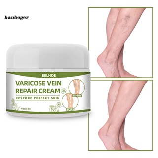 Han_ Gentle Earthworm Leg Ointment Varicose Vein Repair Cream Portable for Postpartum Obese People