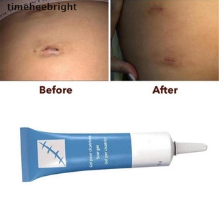 [timehee] 15 g crema de eliminación de cicatrices de acné cicatrices gel estrías acné pigmentación corporal quemadura corporal. (8)