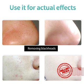removedor de puntos negros crema mascarilla peeling off acné tratamiento natural cuidado de la piel a6j4