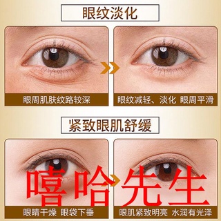 Quick eye bag eliminación de veneno de serpiente crema de ojos elimina e grande 10.16 (4)