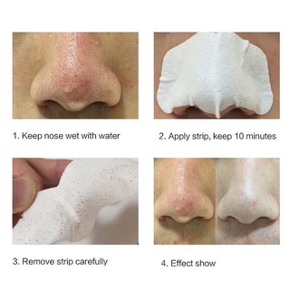 Mascarilla Nasal Parche Para Eliminar Puntos Negros Y Encoger Poros (6)