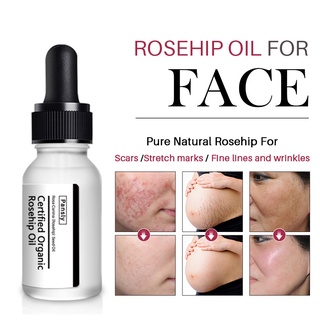 aceite de rosa mosqueta hidratante cuidado de la piel acné cicatriz estrías eliminación de aceite esencial (3)