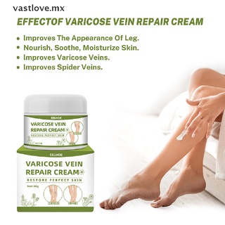 【vastlove】 Spider Leg Gel Effective Varicose Vein Repair Cream for Postpartum Obese People 【MX】