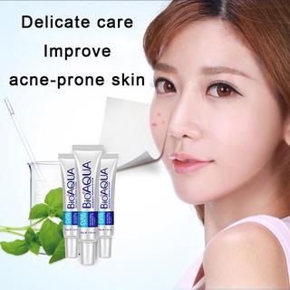 Poquanya Anti-acne Cream Cream Anti-acne Acne Shrink Pores Skin Facial Control Moisturizing P1X2 (7)