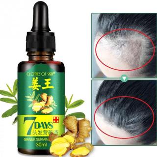 【Spot】1 comprimido de aceite de jengibre de 7 días de edad 30 ml anti-pérdida de cabello suero daño y reparación crecimiento cuidado del cabello esenciaBeauty