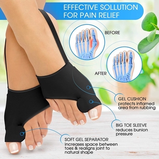 Bunion Corrector Bunion férulas Bunion almohadillas Hallux Valgus tratamiento de juanete calcetines Protector de dedo del pie grande enderezador alivio del dolor para mujeres y hombres