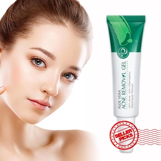 LAIKOU Aloe Vera Gel Anti Acne Treatment Redness Skin Removal Acne Face Gel Cream Anti U4V3