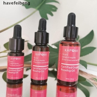 [hagb] aceite de rosa mosqueta certificado de piel orgánica aceite esencial puro y natural mejor aceite facial dfg (1)