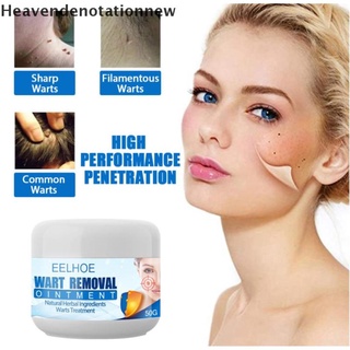 [hdn] removedor de verrugas seguro sin dolor etiquetas de la piel eliminación ungüento de acción rápida removedor crema