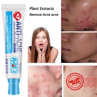 Traditional Chinese medicine Acne Treatment Shrink Pores Bleaching Gel Spots W5Y6