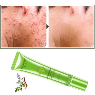 [purpleu]crema De acné mejorar marcas de acné refinar poros cuidado de la piel Danshen crema de acné