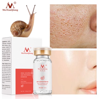 MeiYanQiong Natural Pure Snail Essence Liquid Hyaluronic Acid Whitening Spot Snail Essence Acne Rejuvenation Essence Skin Care
