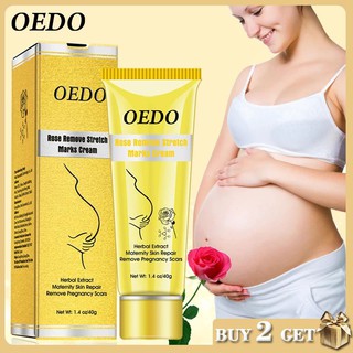 OEDO Rose eliminar estrías crema Anti arrugas Anti envejecimiento eliminar embarazo cicatrices maternidad reparación de la piel crema cuidado del cuerpo