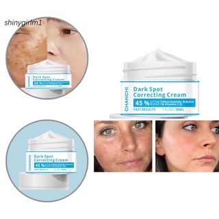 [sg] crema hidratante para el acné/crema hidratante para eliminar manchas oscuras/crema para eliminar la piel