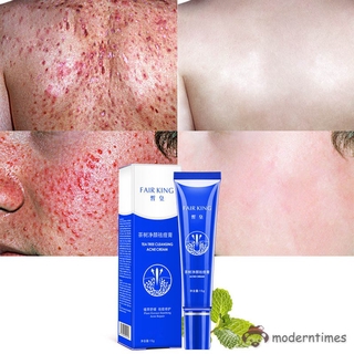 mt crema de fórmula de acción rápida para limpiar acné severo del cuerpo facial (3)