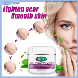 Sunfay-cicatrices crema Facial Para eliminar espinillas/cicatrices/tratamiento De acné/blanqueamiento/Hidratante/crema/cuidado De la piel