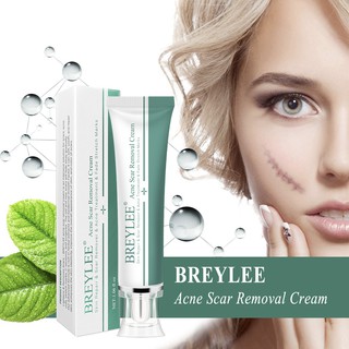 Breylee crema de eliminación de cicatrices de acné reparación de la piel removedor de cicatrices tratamiento del acné se desvanecen las estrías acné-printRemove-scar 30g