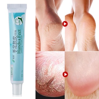 mxgha crema hidratante de manos y pies crema corporal hidrata la piel para los pies hidratante manos peeling seco severamente y3v3 (1)