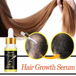 Eelhoe 20ml cuidado del cabello aceite esencial de jengibre aceite de cabello acondicionador dañado reparación del cabello hidratante seco cabeza protector