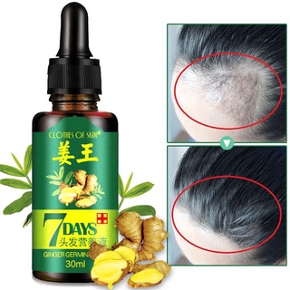 30ml jengibre rápido crecimiento del cabello esencia aceite líquido Anti pérdida de cabello tratamiento ☆Mkhomemall (2)