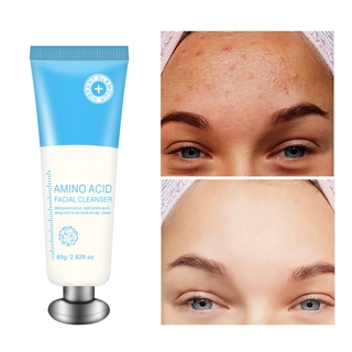 aminoácido limpiador facial limpieza profunda control de aceite eliminar acné hidratante poros retráctiles reafirmante cuidado facial