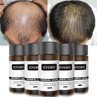 🌹【Ready Stock】Efero hair growth liquid,Ginger Essence Hair Nourishing Scalp Hair Root,Hair nutrient solution,20g