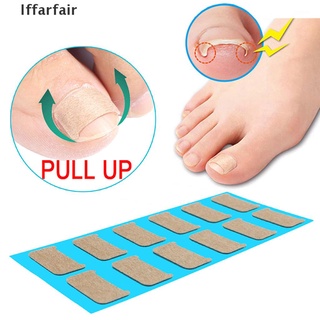 [Iffarfair] Nail Correction Stickers Ingrown Toenail Corrector Patches Paronychia Treat Tool .