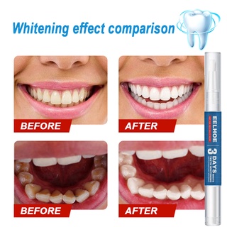 【WholeSale】 3g lápiz blanqueador de dientes efecto rápido iluminar dientes vitamina E manchas eliminación de cuidado Oral pluma para Dental (3)