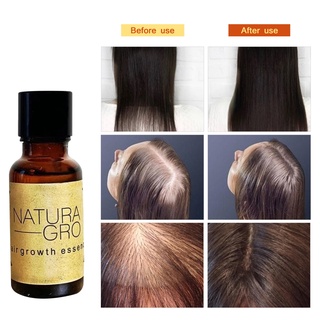 20G Hair Growth Serum Hair Growth Essential Oil Anti Detachment Repair Scalp Hair Care Solution (5)