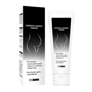 Stretch Marks Cream Remove Pregnancy Scars Acne Women Repair Anti-Aging Anti-Winkles Firming Body Cream (1)
