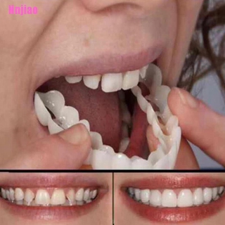 <Nnjiao> nueva simulación de blanqueamiento superior e inferior fila tirantes dientes blanqueamiento conjunto
