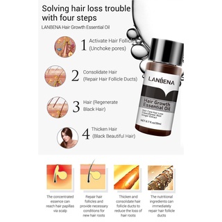 [LACOOPPIA] Aceite esencial para el crecimiento del cabello, tratamiento para la prdida y adelgazamiento del cabello, suero para el (9)