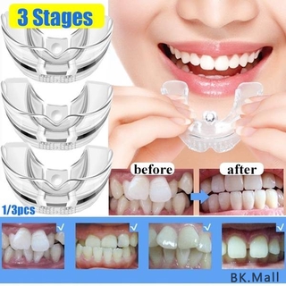 3 etapas ortodoncia ortodoncia aparatos dentales tirantes alineación entrenador retenedor de dientes bruxismo protector de la boca enderezador de dientes