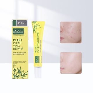 tratamiento eficaz del acné puntos negros eliminar anti acné reparación crema control de aceite retráctil poros cicatriz eliminar cuidado de la cara blanqueamiento 20g