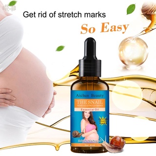 Aceite esencial Para el cuidado De la piel Elástica Para eliminar embarazo/desemplazo/desemplazo (3)