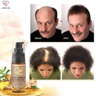 spray universal para el cabello/suero hidratante para el cabello/tratamiento de pérdida (3)