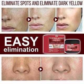Effective Anti-Acne Cream Acne Treatment Fade Acne Pores Moisturizing Acne Skin Whitening Care G8N5 (6)