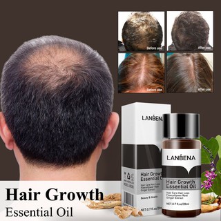 Rápido potente crecimiento del cabello esencia productos tratamiento de aceite esencial prevenir la pérdida del cabello cuidado del cabello Andrea 20ml