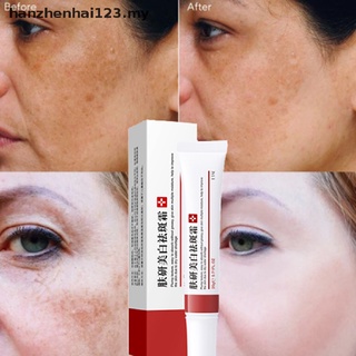 [hanzhenhai123] Crema blanqueadora de pecas eliminar Melasma acné punto pigmento melanina crema cara [MY]
