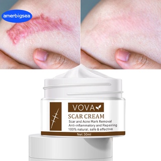 Cuidado de la piel tratamiento cicatrices Gel blanqueadora elástica crema cicatrices Suaves piel Natural Para mujer