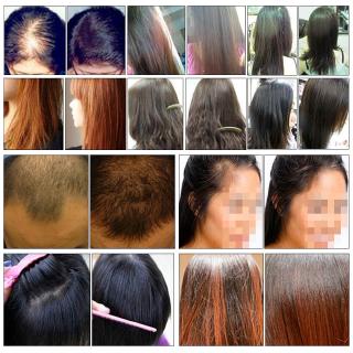Andrea líquido crecimiento del cabello esencia Natural planta fórmula crecimiento del cabello esencia Anti-pérdida de cabello producto de regeneración 20ml (2)